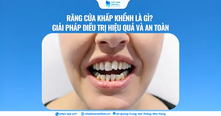 Răng cửa khấp khểnh là gì? Giải pháp điều trị hiệu quả và an toàn
