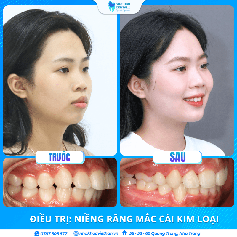 Hành trình Huyền Diệu