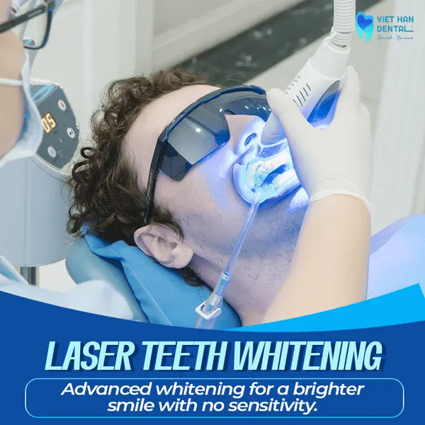 Lase Teeth Whitening
