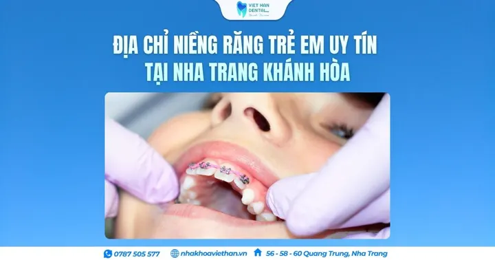 Địa chỉ niềng răng trẻ em uy tín tại Nha Trang Khánh Hòa