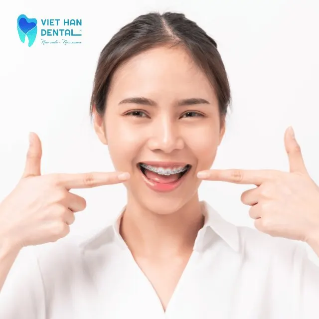Niềng răng chỉnh nha Nha Trang