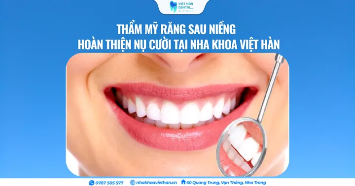 Thẩm mỹ răng sau niềng – Hoàn thiện nụ cười tại Nha khoa Việt Hàn