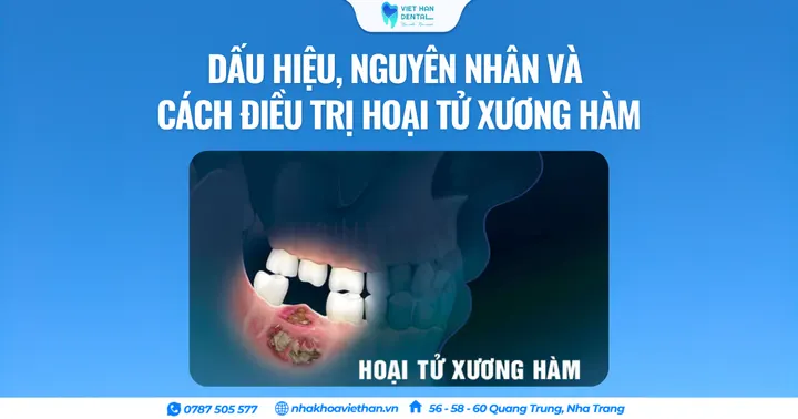 Dấu hiệu, nguyên nhân và cách điều trị hoại tử xương hàm