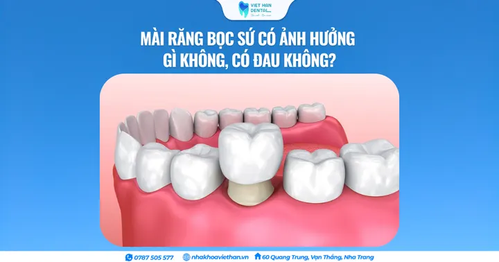 Mài răng bọc sứ có ảnh hưởng gì không, có đau không?