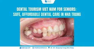 Dental Tourism Viet Nam for Seniors: Safe, Affordable Dental Care in Nha Trang