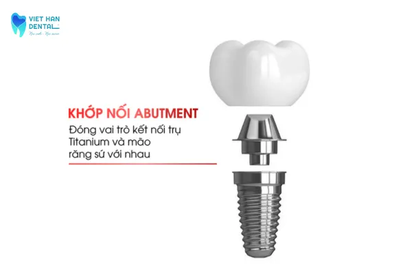 "Khớp