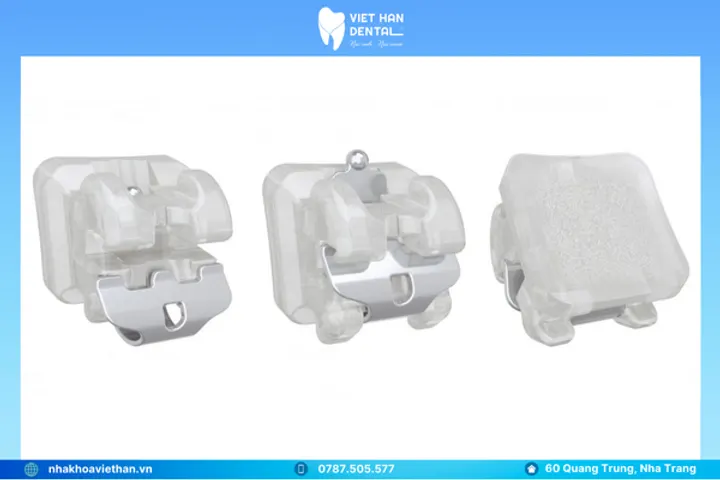 Mắc cài sứ tự buộc EMPOWER CLEAR American Orthodontics