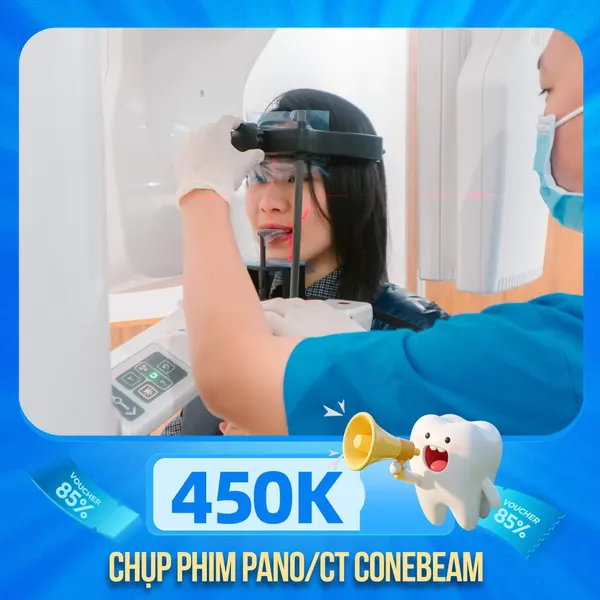 Chụp Phim