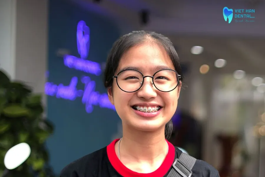 Niềng răng tăng trưởng an toàn và hiệu quả tại Nha khoa Việt Hàn