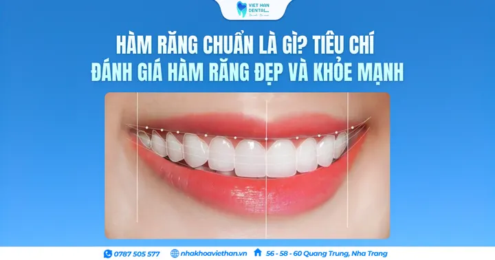 Hàm răng chuẩn là gì? Tiêu chí đánh giá hàm răng đẹp và khỏe mạnh