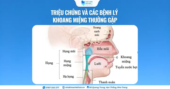 Triệu chứng và các bệnh lý khoang miệng thường gặp
