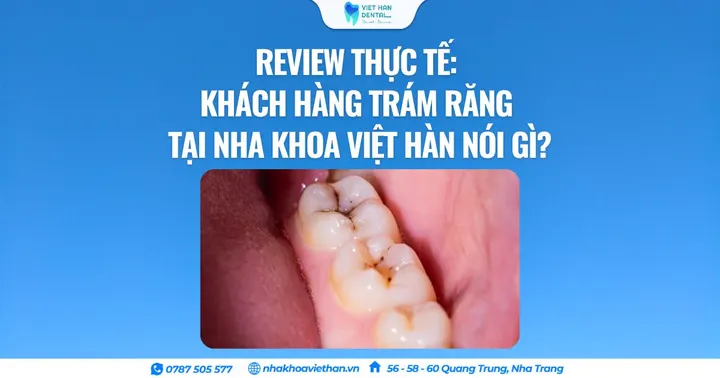 Review thực tế: Khách hàng trám răng tại Nha khoa Việt Hàn nói gì?