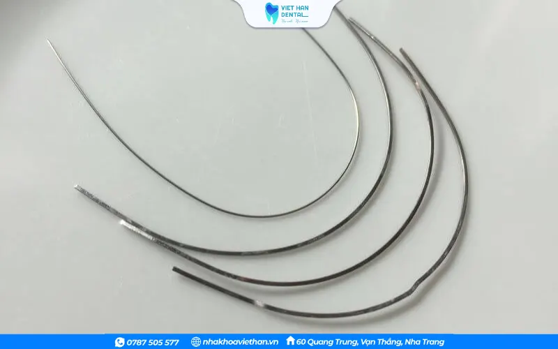 "Dây cung niềng răng bằng kim loại quý