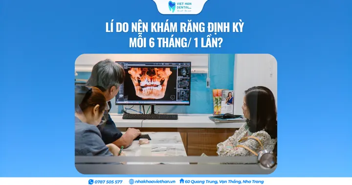 Lí do nên khám răng định kỳ mỗi 6 tháng/ 1 lần?
