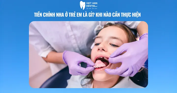 Tiền chỉnh nha ở trẻ em là gì? Khi nào cần thực hiện  