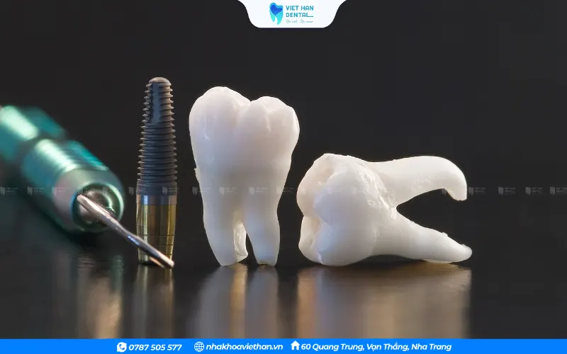Nha khoa Việt Hàn - Địa chỉ nha khoa hàng đầu tại Khánh Hòa