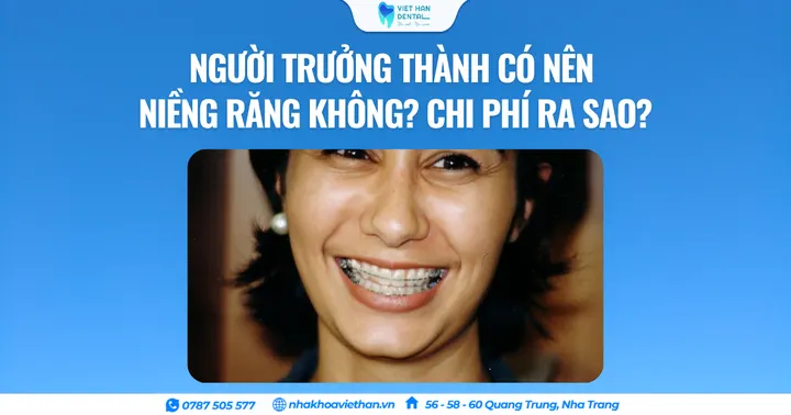 Người trưởng thành có nên niềng răng không? Chi phí thực hiện?