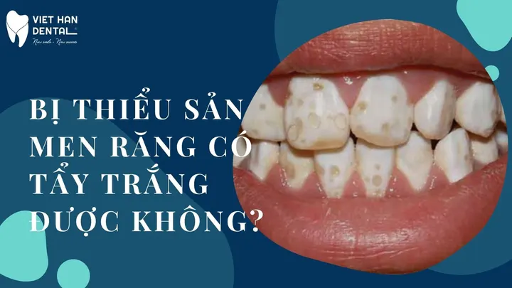Tẩy trắng răng có hiểu quả với thiểu sản men răng không?