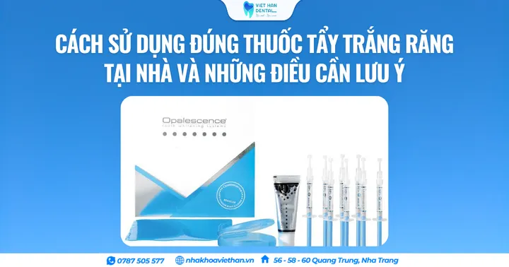 Cách sử dụng đúng thuốc tẩy trắng răng tại nhà và những điều cần lưu ý