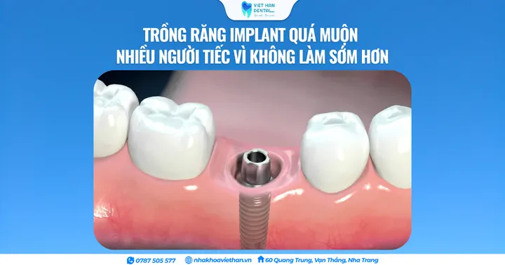 Trồng răng Implant quá muộn – Nhiều người tiếc vì không làm sớm hơn