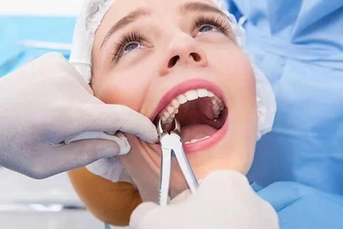 Răng khôn là tên gọi được dùng để chỉ những chiếc răng hàm mọc cuối cùng của mỗi bên hàm