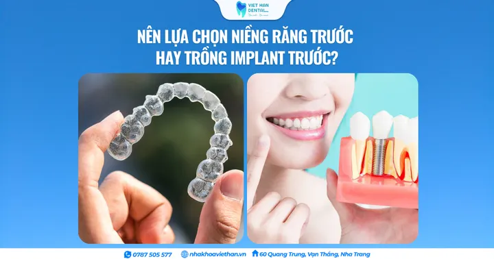 Nên lựa chọn niềng răng trước hay trồng Implant trước?