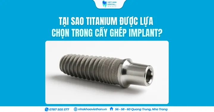 Tại sao Titanium được lựa chọn trong cấy ghép Implant?