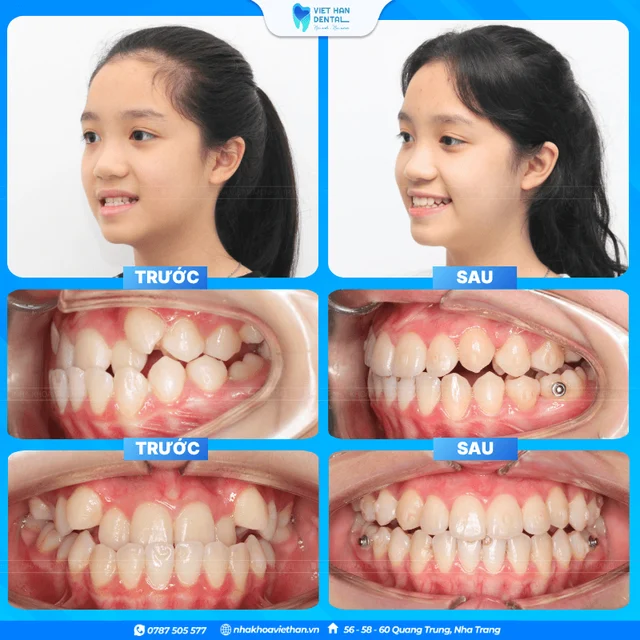 Hình ảnh khách hàng 3 của Bác sĩ Hồng Thạnh An