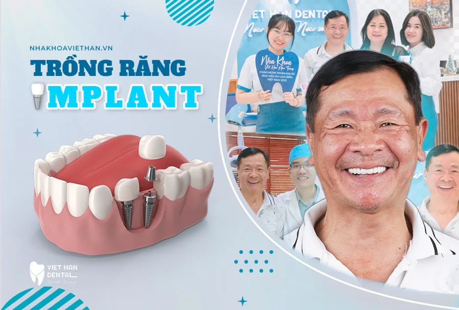 Trồng răng Implant