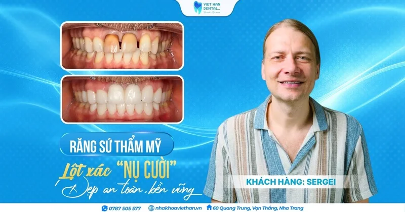 KHÁCH HÀNG NHA KHOA THẨM MỸ – Hình 3