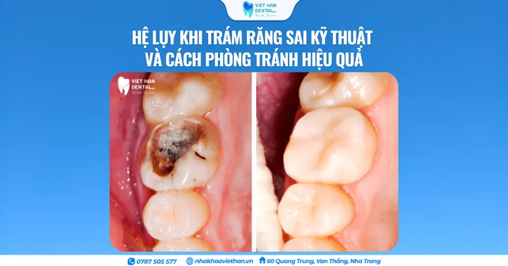 Hệ lụy khi trám răng sai kỹ thuật và cách phòng tránh hiệu quả
