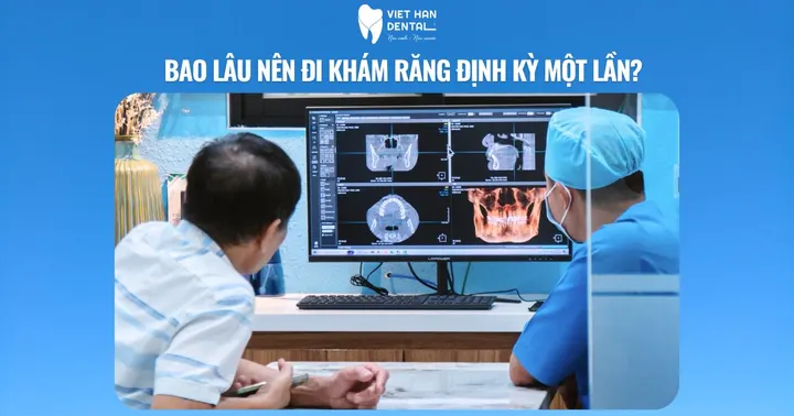 Bao lâu nên đi khám răng định kỳ một lần?