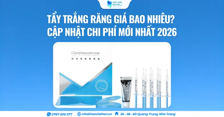 Tẩy trắng răng giá bao nhiêu? Cập nhật chi phí mới nhất 2026