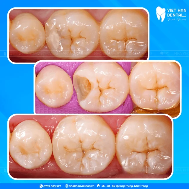 Hình ảnh khách hàng 3 của Bác sĩ Văn Thanh Nga