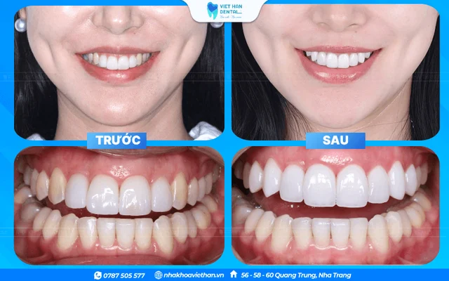 Hình ảnh khách hàng 2 của Bác sĩ Hoàng Thị Thảo Ngân