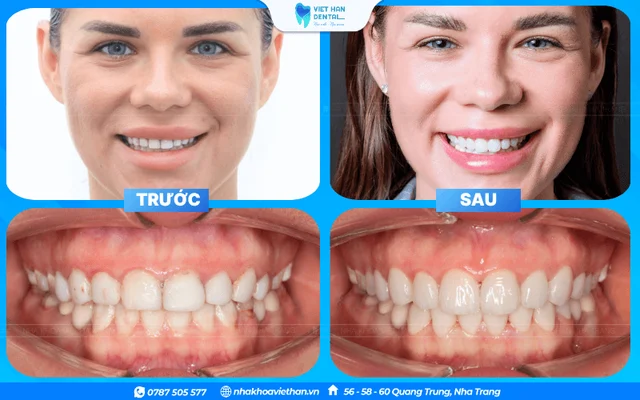 Hình ảnh khách hàng 2 của Bác sĩ Lê Châu Hưng Thịnh
