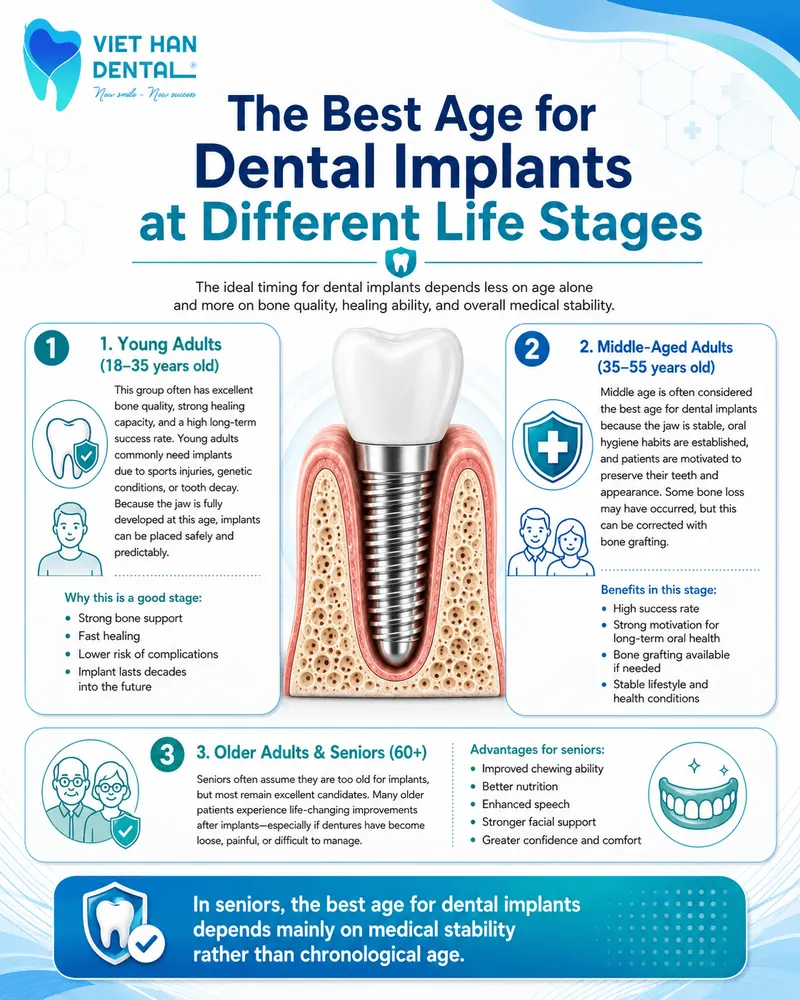 The best age for dental implants varies depending on the stage of life.