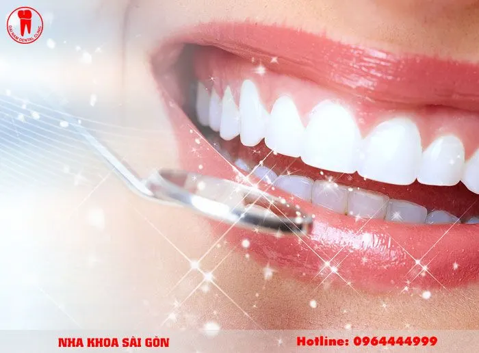 Dia Chi Dan Su Veneer Tai Nha Trang 3