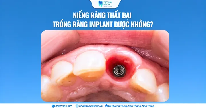 Niềng răng thất bại trồng răng implant được không?