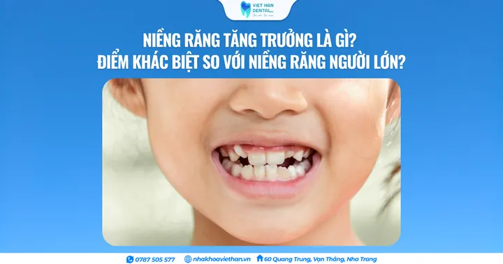 Niềng răng tăng trưởng là gì? Điểm khác biệt so với niềng răng người lớn?