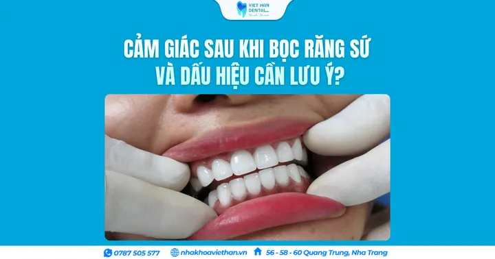 Cảm giác sau khi bọc răng sứ và dấu hiệu cần lưu ý?