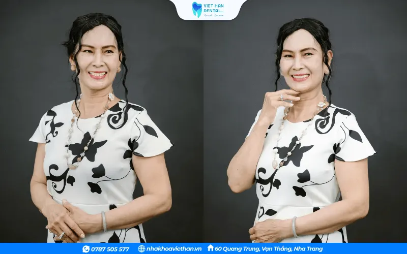 Mrs. An looked confident and radiant after getting her new set of teeth.