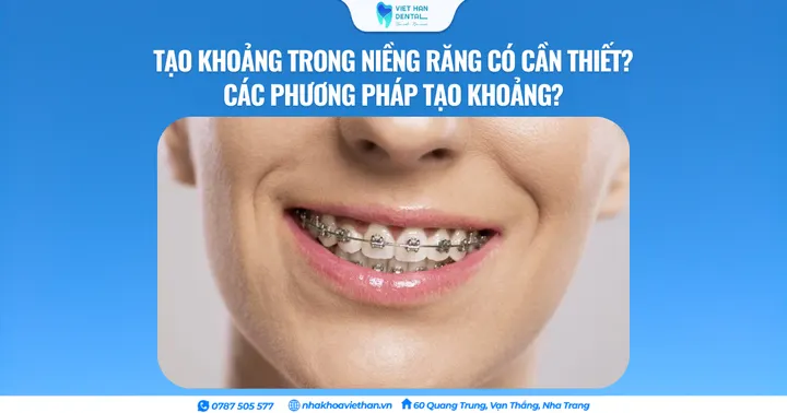 Tạo khoảng trong niềng răng có cần thiết? Các phương pháp tạo khoảng?