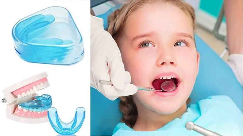 Độ tuổi từ 7 – 12 tuổi còn được đánh giá là thời điểm “vàng” để chỉnh nha cho trẻ