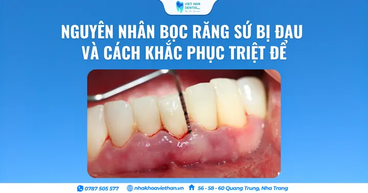 Nguyên Nhân Bọc Răng Sứ Bị Đau Và Cách Khắc Phục Triệt Để