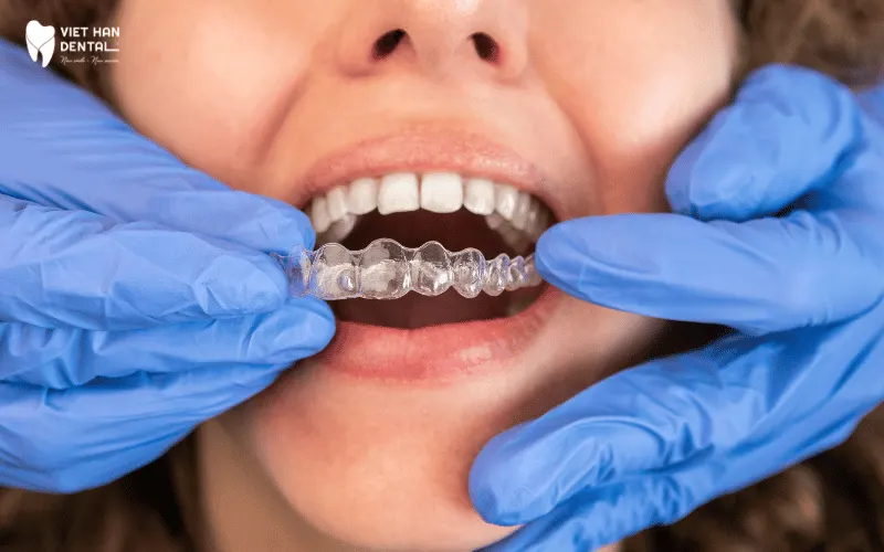 Bắt đầu đeo chúng theo lịch trình đã được lên kế hoạch
