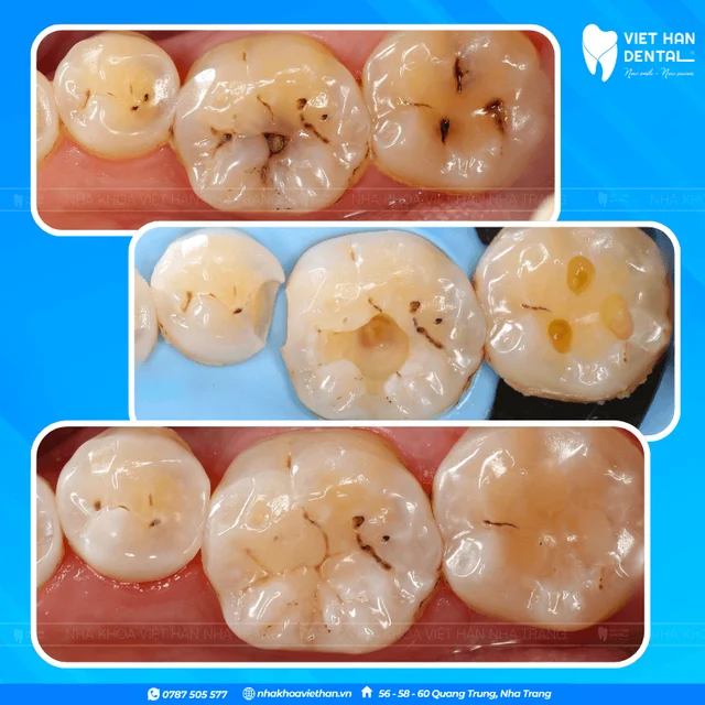 Hình ảnh khách hàng 4 của Bác sĩ Văn Thanh Nga