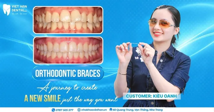 An Orthodontic Journey Preparing for a New Beginning in the U.S.