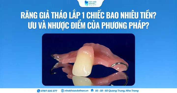 Răng giả tháo lắp 1 chiếc bao nhiêu tiền? Ưu và nhược điểm của phương pháp?