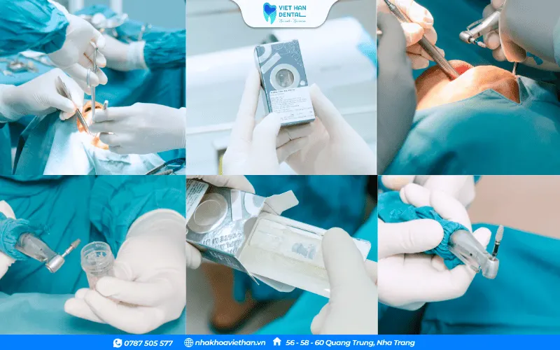 The implant post is placed directly into the jawbone